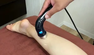 肉離れ治療風景